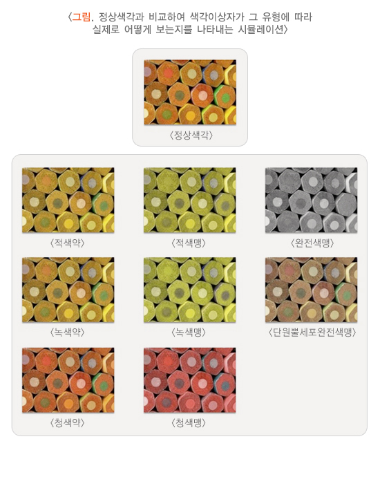  색각이상(색맹) 증상과 치료 방법