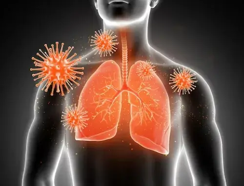 폐의-손상으로-발생하는-폐부종