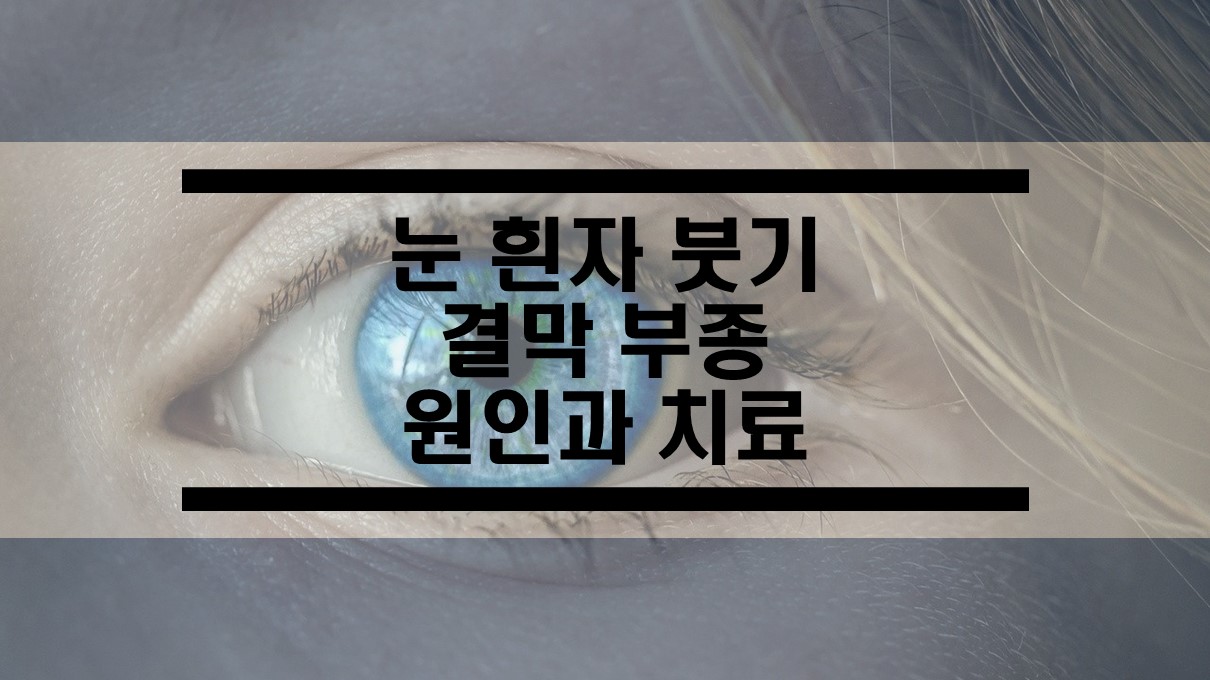  눈 흰자 부음 결막 부종의 원인과 치료법