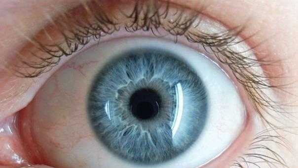 눈동자의 파란색 변색 (Blue Sclera)