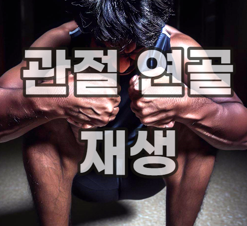 관절-연골-재생-무릎-회복-방법-치료-닳음-염증-영양제-원인