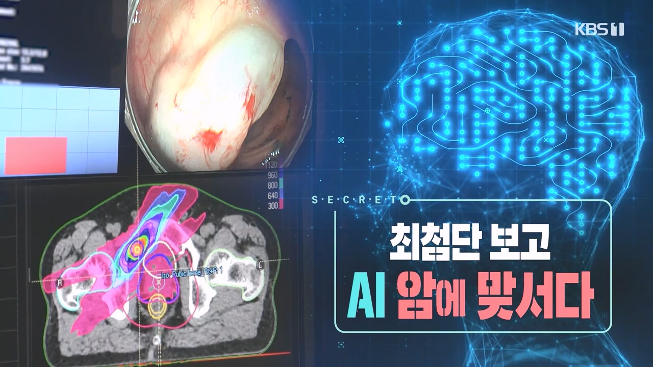 생로병사의 비밀.E881.230831p-NEXT.mp4_20230901_221805.107.jpg