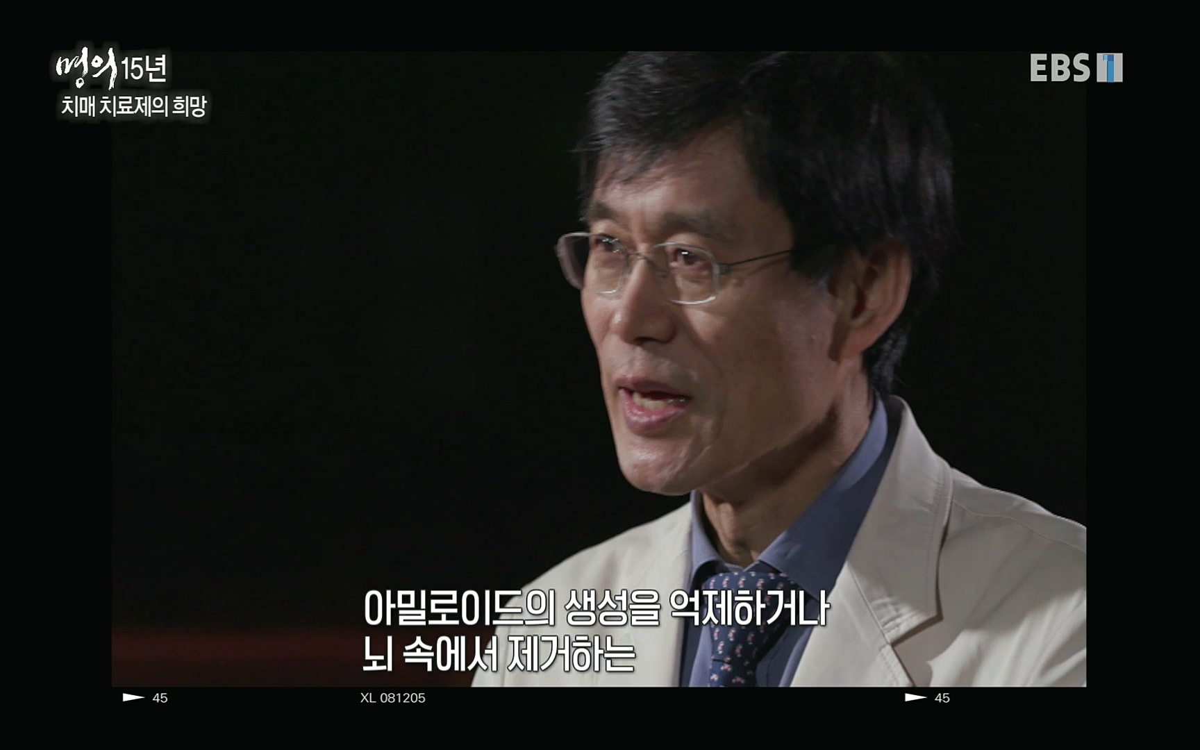 EBS 명의 헬스케어 - TV - 교육의 중심 EBS명의 15년 치매 치료의 패러다임이 바뀐다.mp4_20220808_211019.227.jpg