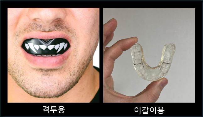 왼쪽은-격투선수용-마우스피스-오른쪽은-이갈이용-마우스피스