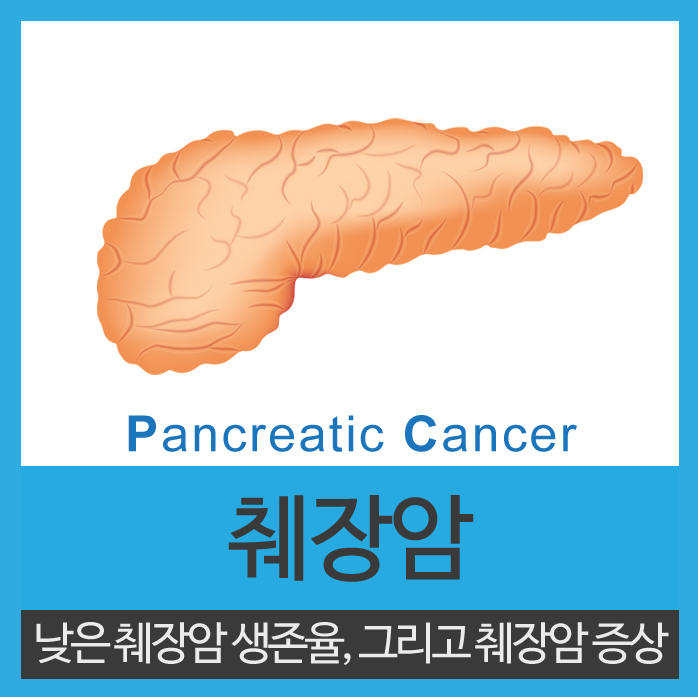  췌장암 증상 매우 낮은 생존율 더  주의하세요