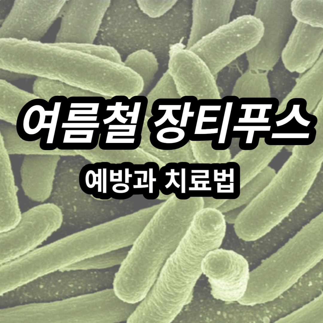 장티푸스