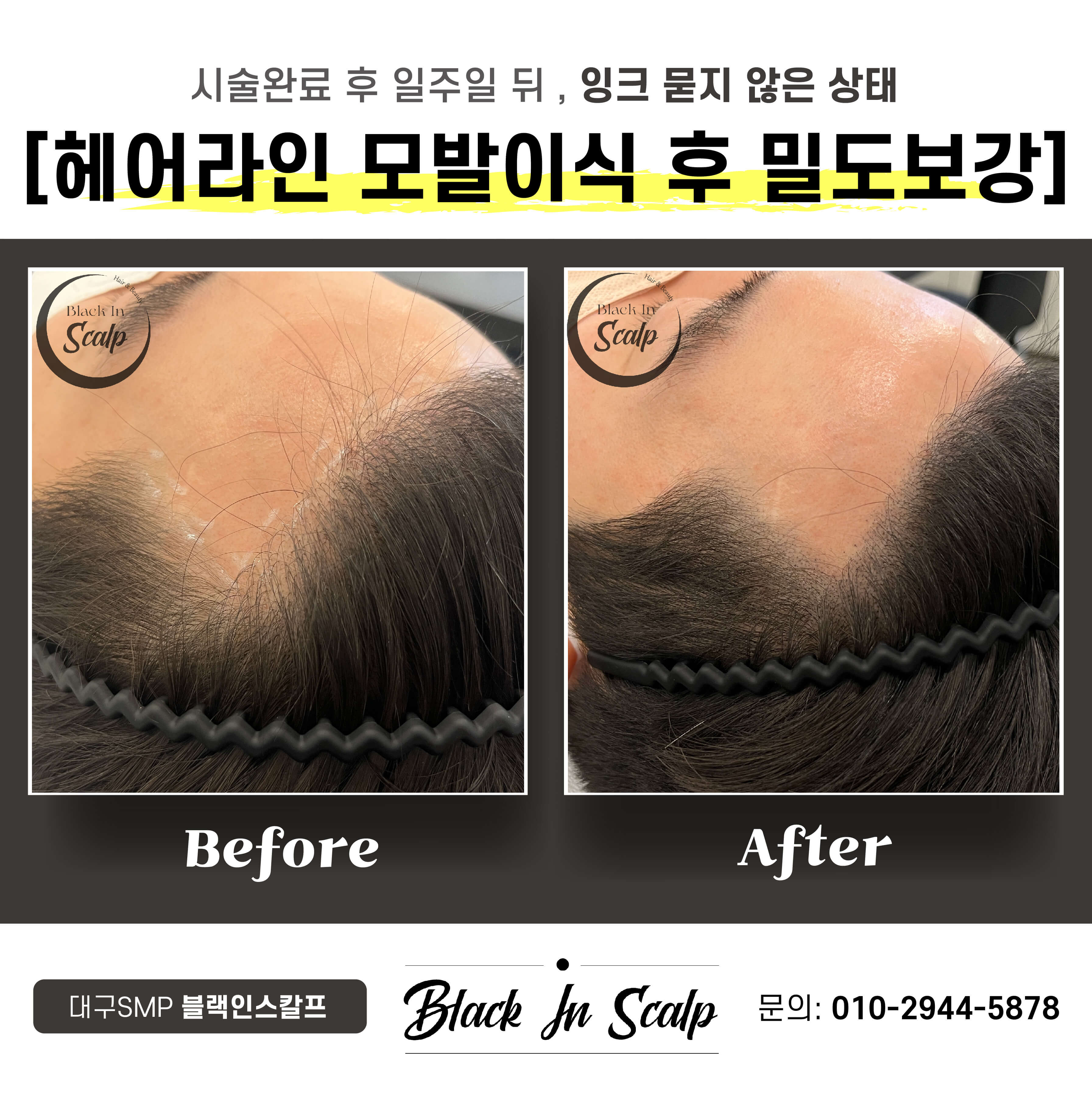 블랙인스칼프 이미지