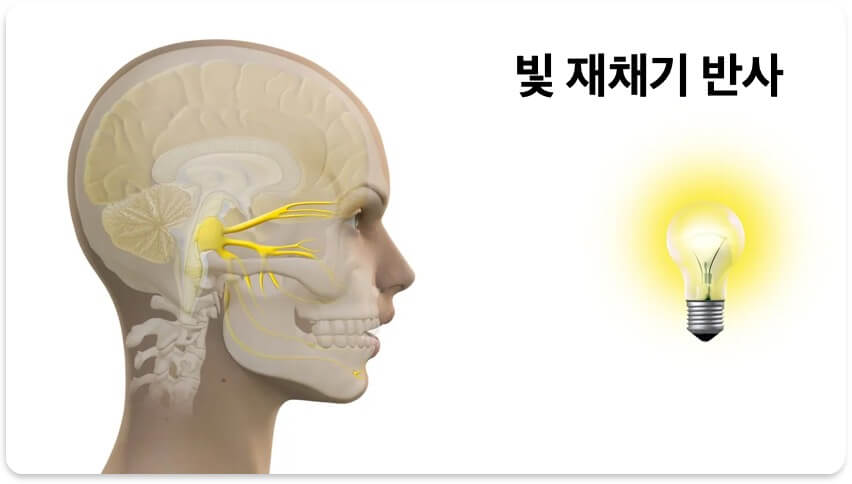 빛 재채기 반사