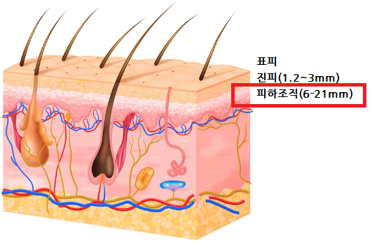 인슐린 똑똑하게 사용하기, 자가혈당 측정 방법, 인슐린 용량 조절 방법 - 인슐린 주사 시 주의사항 - 2) 인슐린 펜니들(주사바늘) 인슐린 똑똑하게 사용하기, 자가혈당 측정 방법, 인슐린 용량 조절 방법 - 인슐린 주사 시 주의사항 - 2) 인슐린 펜니들(주사바늘)