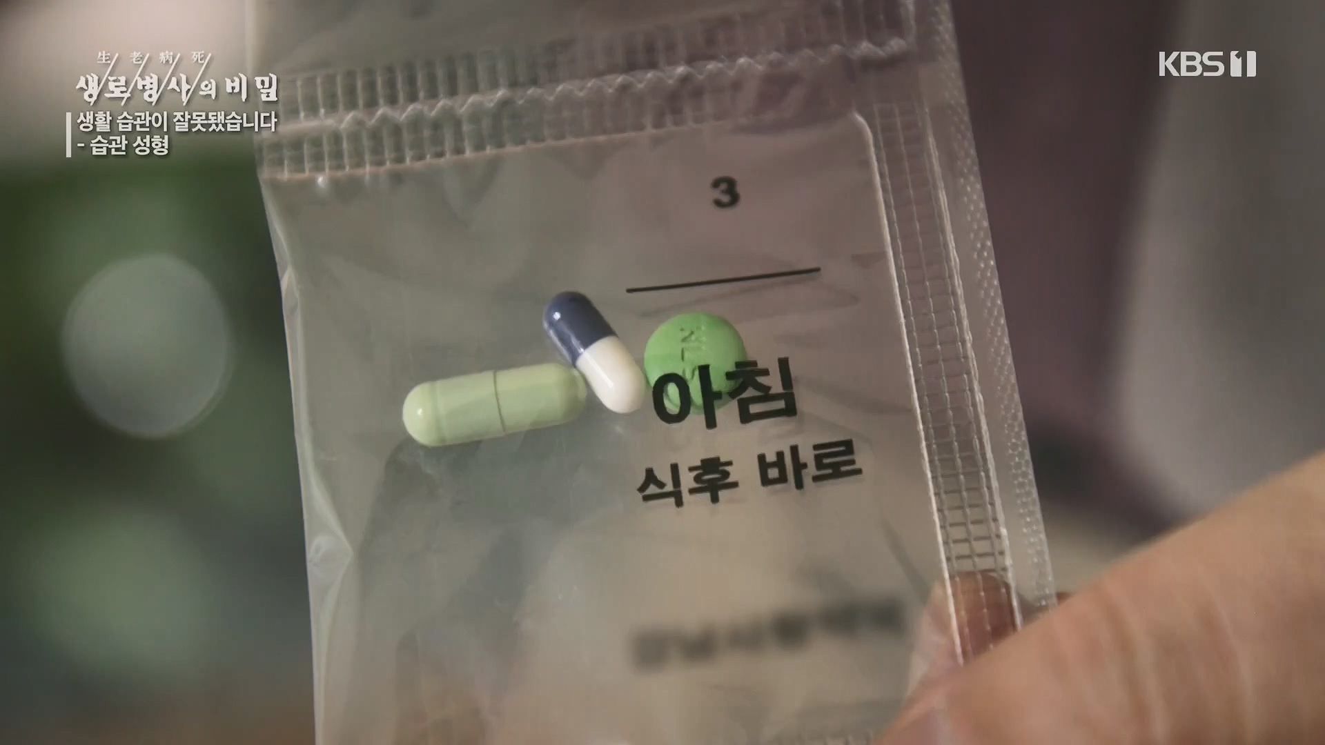 생로병사의 비밀.E867.230503p.H264-F1RST.mp4_20230504_210417.131.jpg