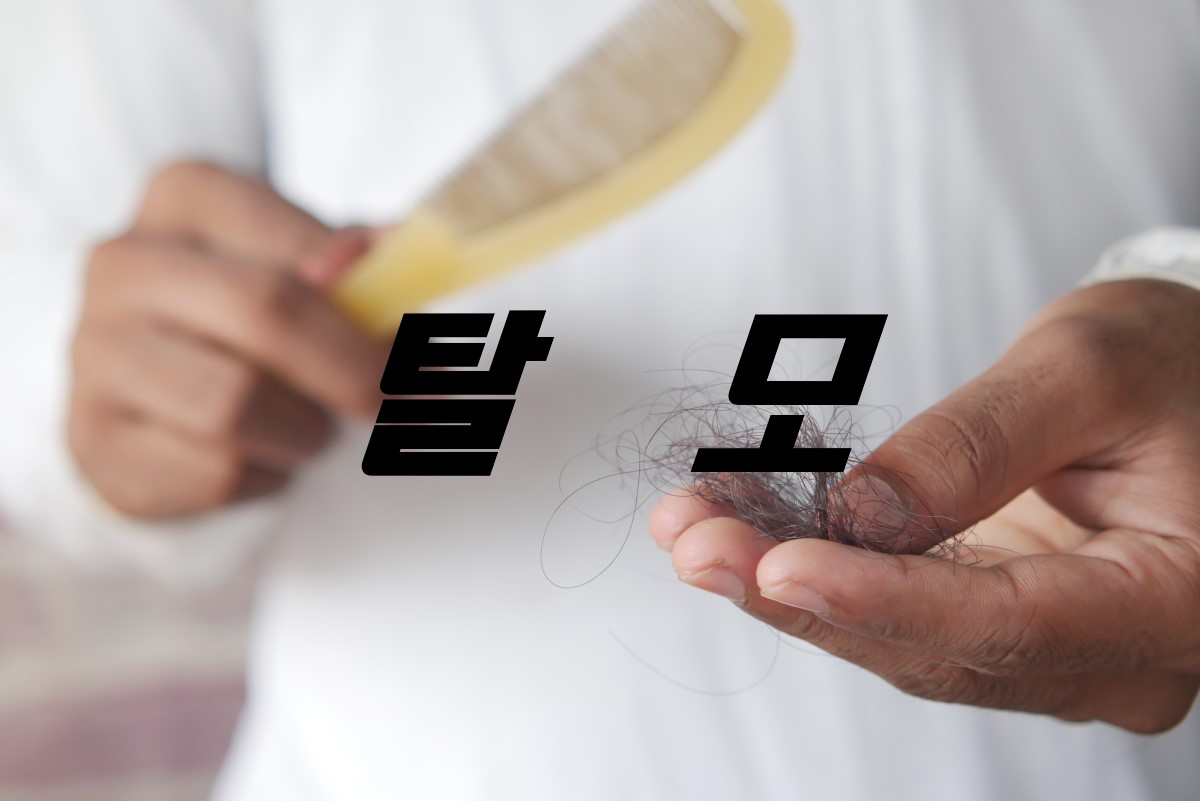 탈모