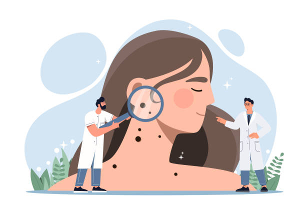  피부암 종류에 따른 원인 및 증상 그리고 피부암 치료