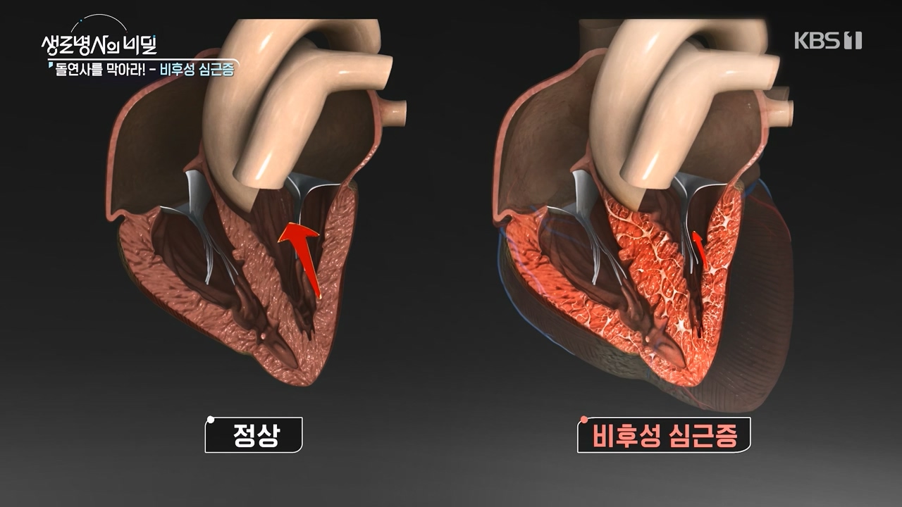 생로병사의 비밀.E912.240523p-NEXT.mp4_20240523_201952.675.jpg