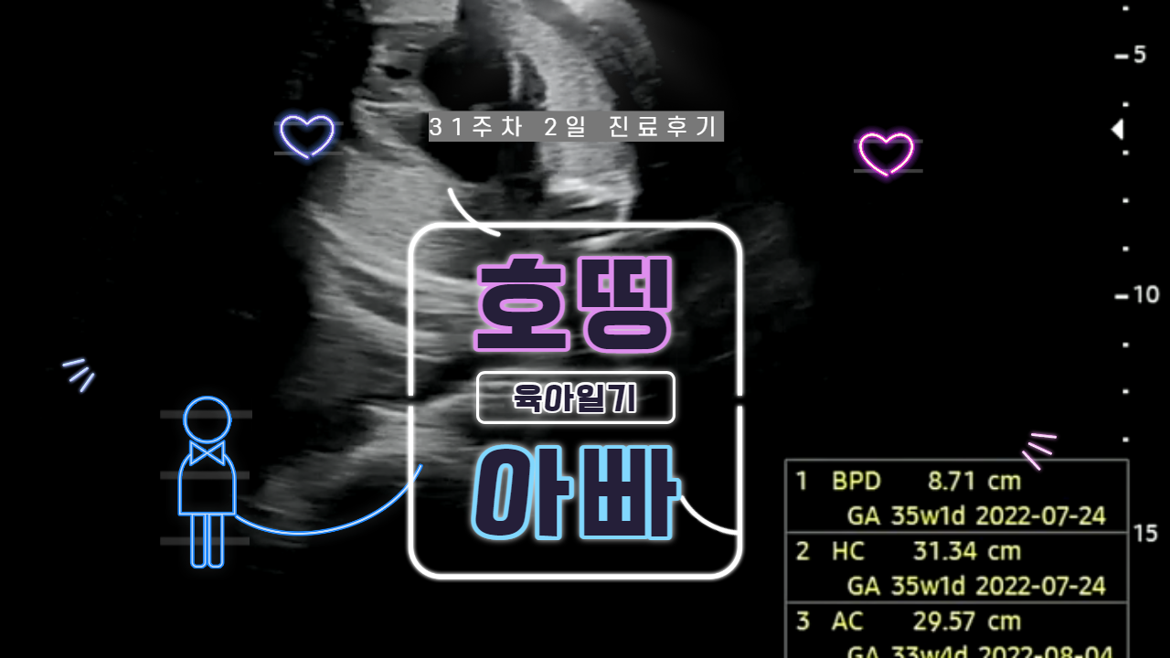  태아 31주차 2일 초음파 진료 후기