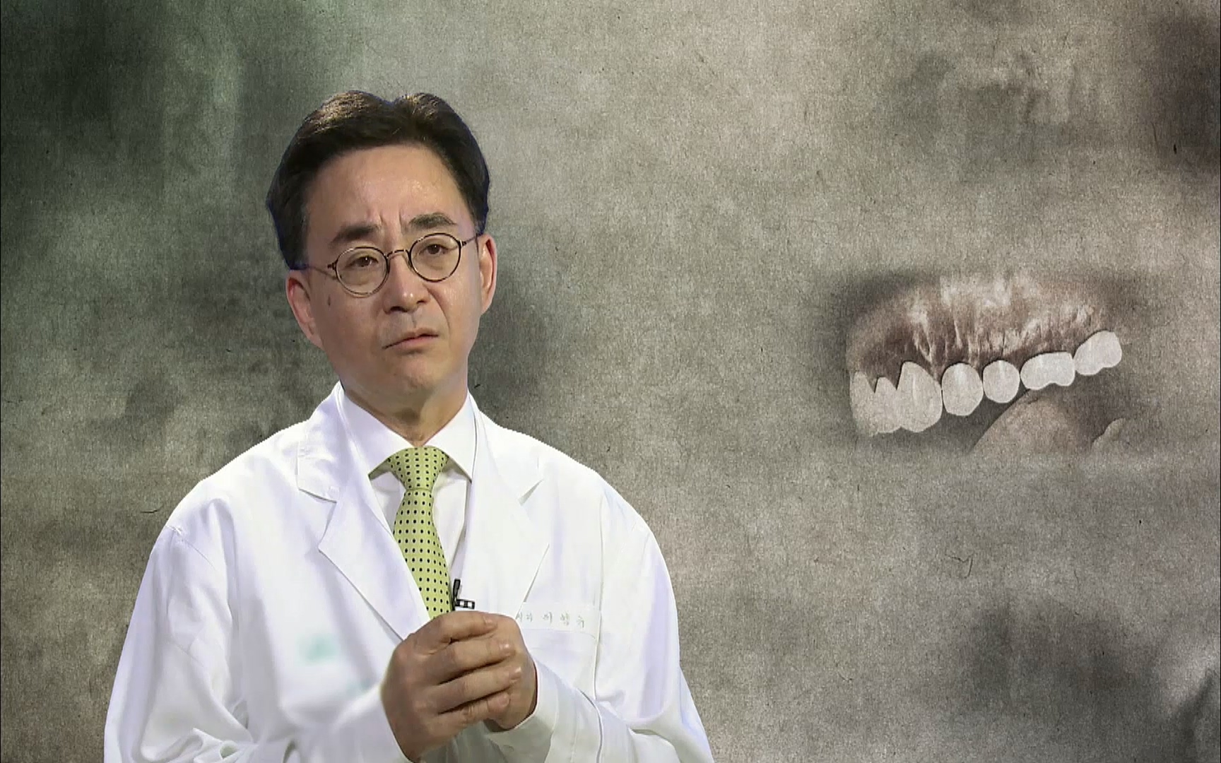 EBS 명의 헬스케어 - TV - 교육의 중심 EBS2015년 1월 16일 (금) 밤 9시 50분, EBS1.mp4_20220505_150357.900.jpg