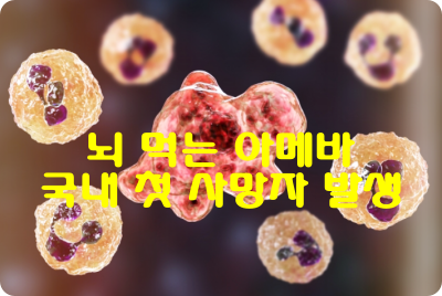 ‘뇌 먹는 아메바’ 국내 감염 첫 사례 : 50대 남성 사망