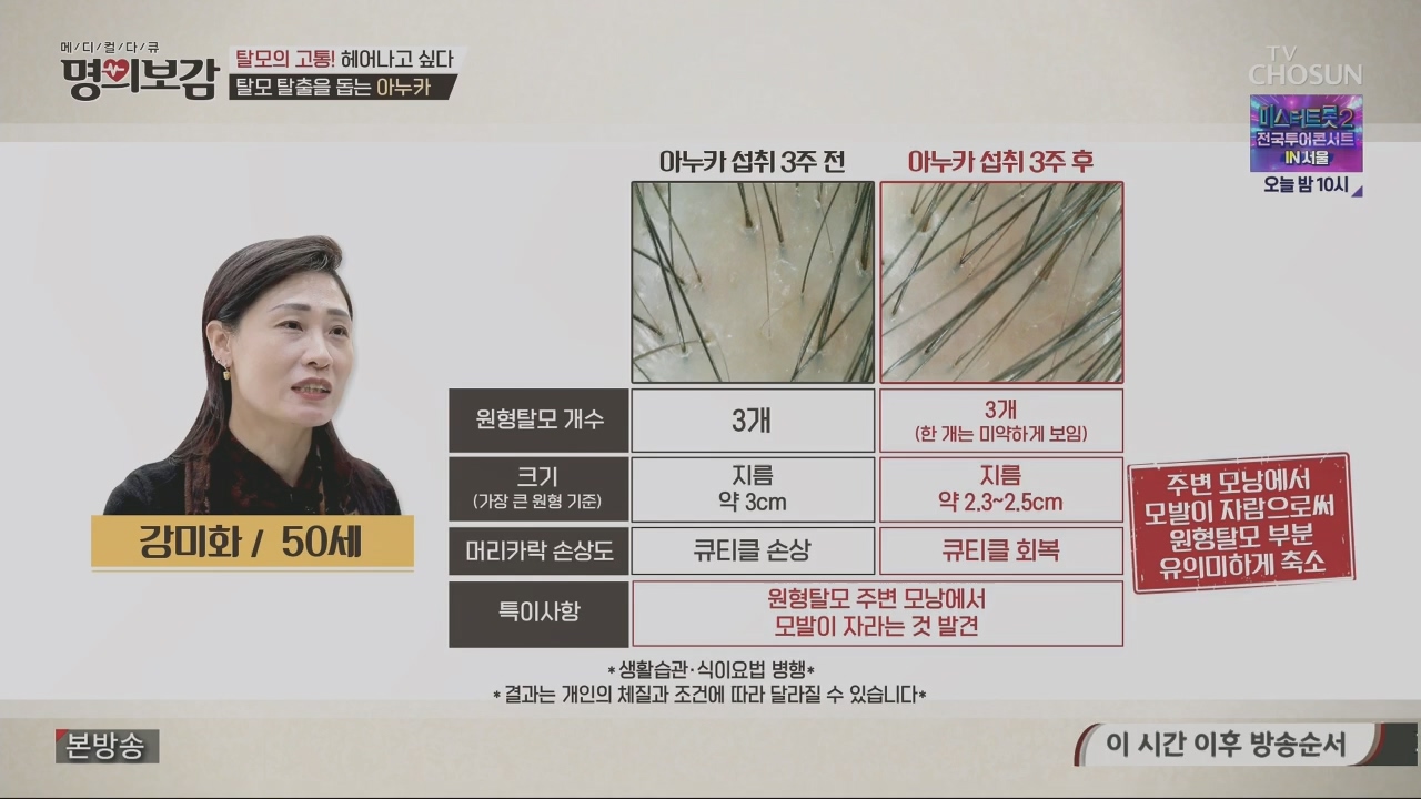 메디컬다큐 명의보감.E03.230527p.H264-F1RST.mp4_20230529_173128.411.jpg