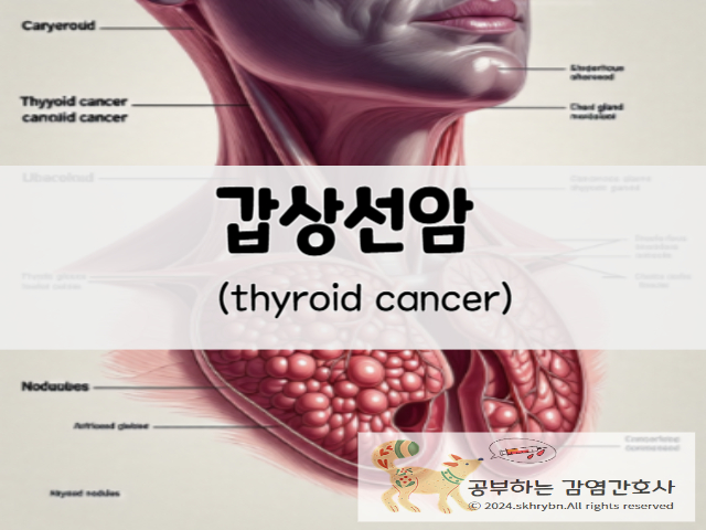 성인 간호_갑상선 암(Thyroid cancer)원인 및 종류, 초기 증상 과 수술, 간호 진단