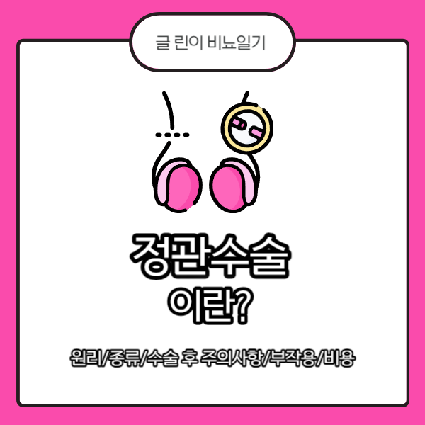  정관수술 이란? 원리/종류/수술 후 주의사항/부작용/비용
