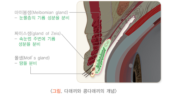 다래끼개념도