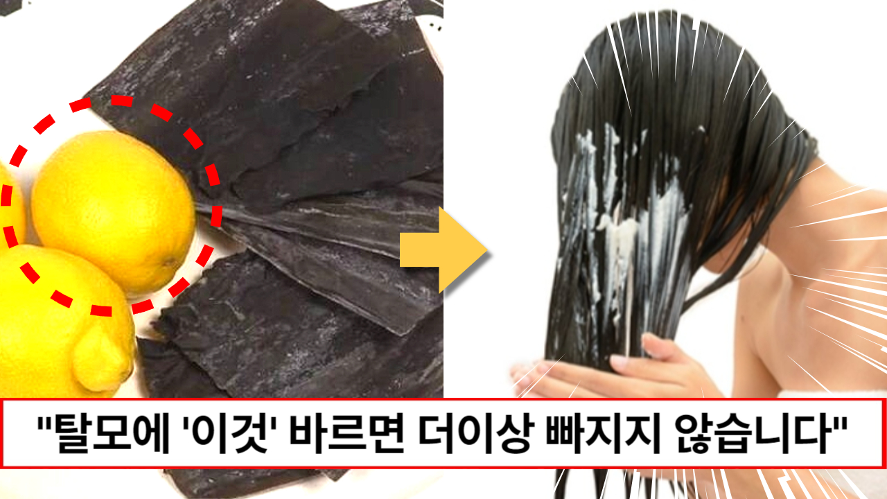 “탈모라면 속는셈치고 꼭 해보세요” 집에서 탈모 잡는 마법의 레몬 다시마 팩 만드는 방법