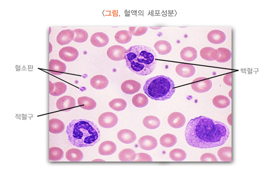  빈혈