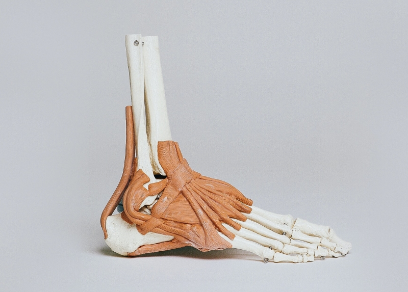 발모양의 뼈사진