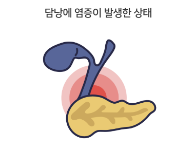 담낭염의 증상&amp;#44; 제거 수술&amp;#44; 치료 원인 좋은 음식 알아보기