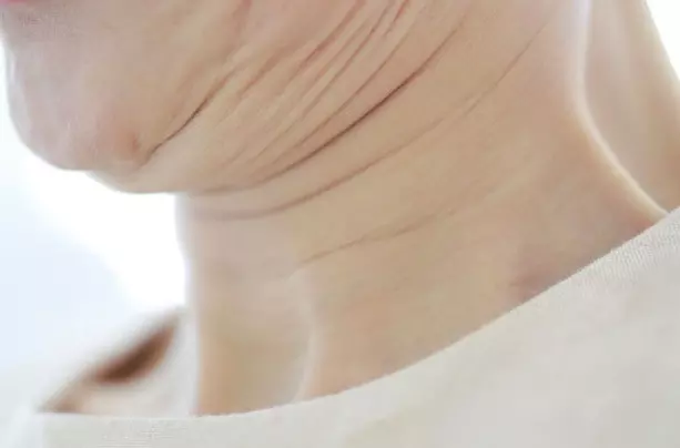 목주름