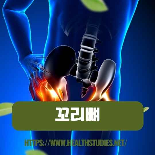 꼬리뼈 통증-사진-4