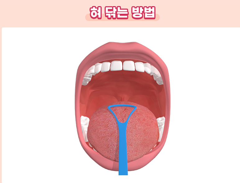 입냄새 해결 방법