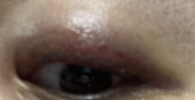 아이라인반영구 12