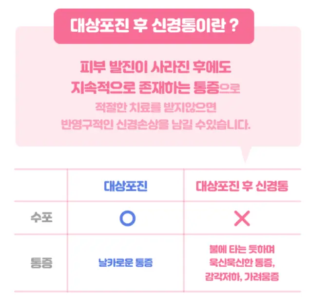 대상포진 신경통