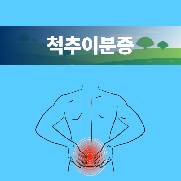척추이분증