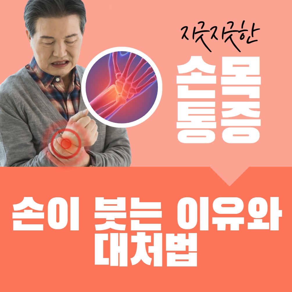 아침에-손이-붓는-이유와-해결방법