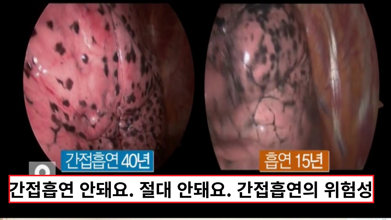  간접흡연 안돼요. 절대 안돼요. 간접흡연의 위험성