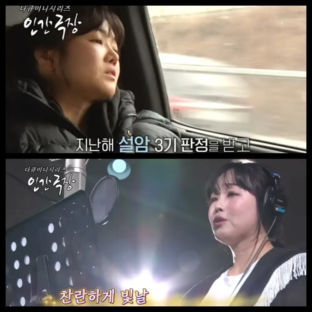  미스트롯 정미애 설암 3기로 혀 절제 후 근황