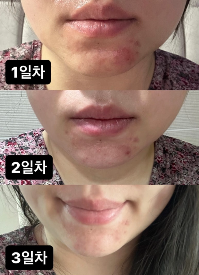 세라일론 수딩밤 내돈내산