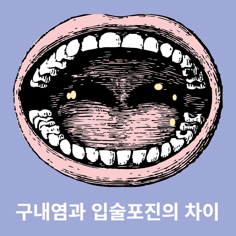 구내염