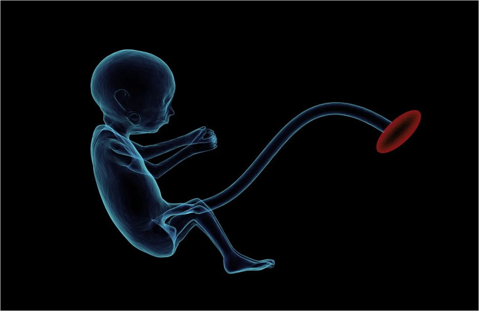 태반주사의 [미사역 필라테스] 1