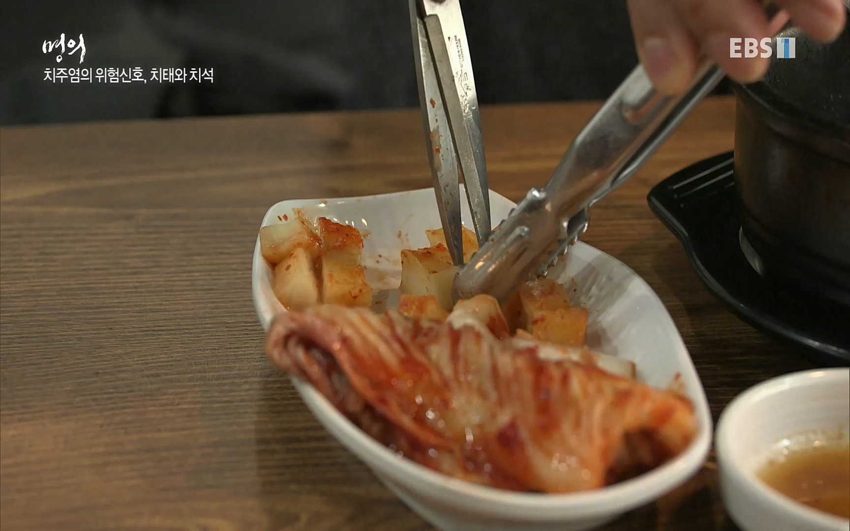 EBS 명의 헬스케어 - TV - 교육의 중심 EBS치주염이 코로나로 소홀해진 구강관리가 치아를 더 망가트리고 위험하게 만들며, 증상이 없기 때문에 특히 더 조심하고 치은염 단계에서 진행되지 않도록 예방해야한다 정의원 교수님과 치_20220505_151712.773.jpg