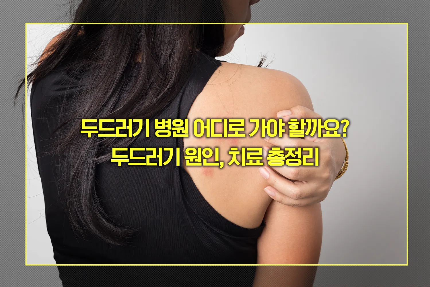 두드러기 원인, 치료