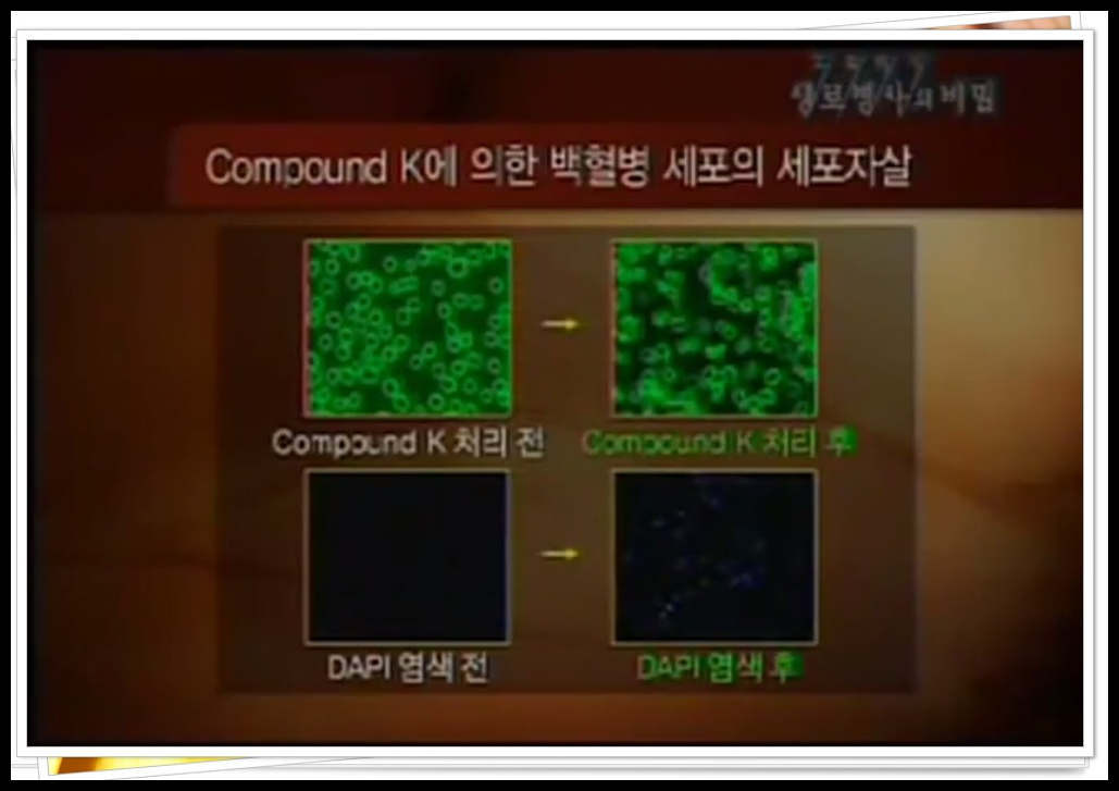 자궁경부암 반응성 세포변화