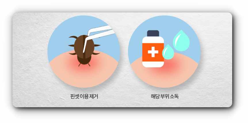 진드기대처법