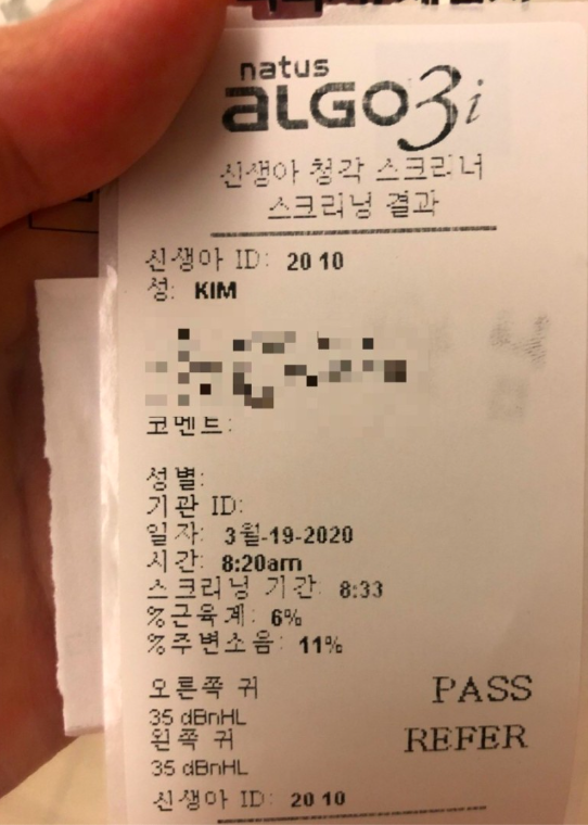  신생아 청력 검사 결과 왼쪽 귀 재검 (Refer)