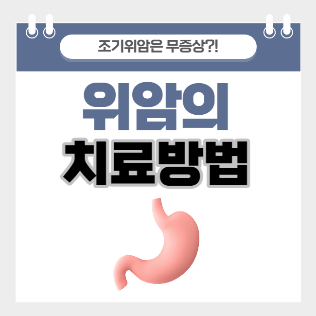  증상이 없는 위암, 치료법 완전 정복(feat. 수술의 종류)