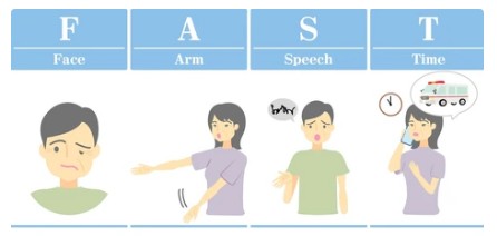 뇌경색 전조증상 체크리스트