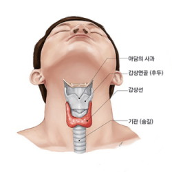  갑상선 목부음 통증 (갑상선암 초기증상 및 원인)