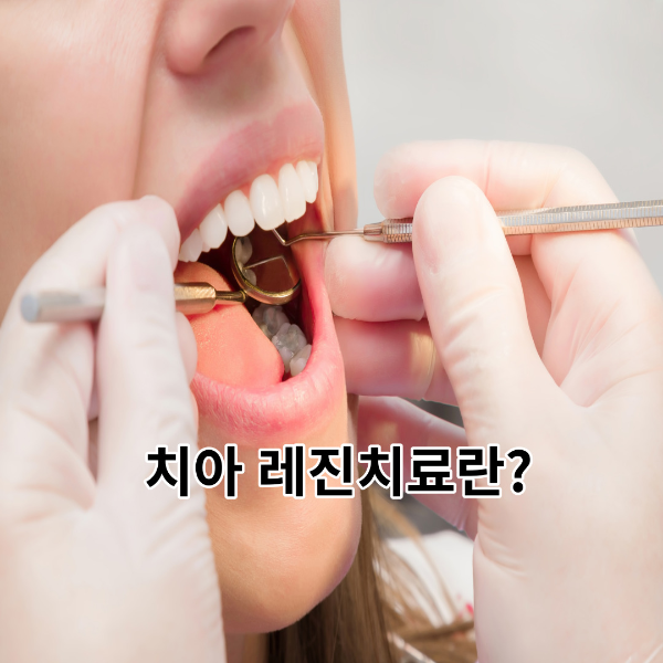 치아-레진치료-썸네일