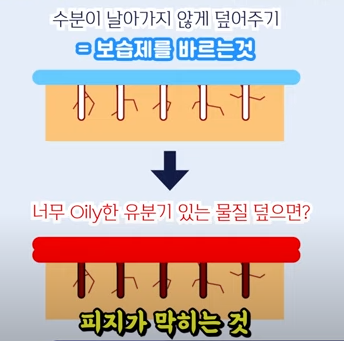  지성피부 건성피부 수부지에 대한 정의